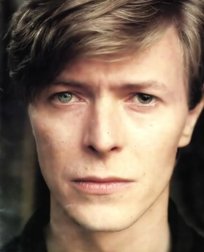 David Bowie Augen heterochromia