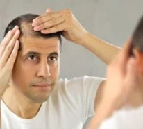 Was hilft gegen Haarausfall – die wichtigsten Methoden und Alternativen